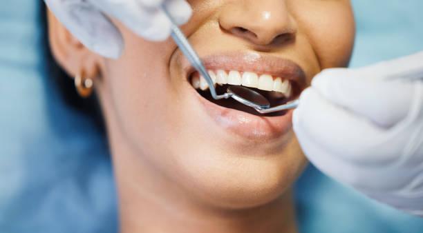 Best Emergency Dentist for Lost Fillings or Crowns in Sacred Heart University, CT