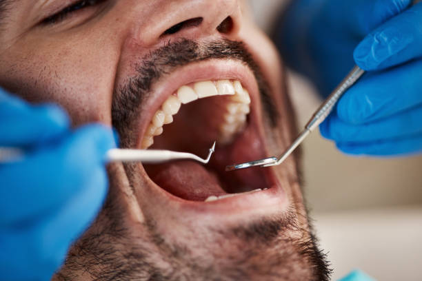 Best Emergency Dental Extractions in Sacred Heart University, CT